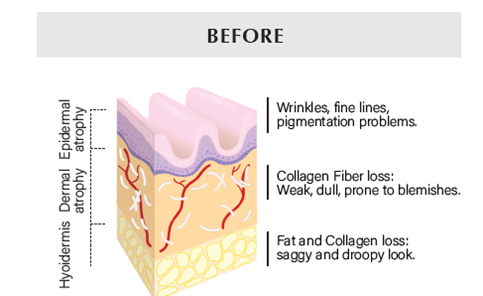 FaceLift Reformation System