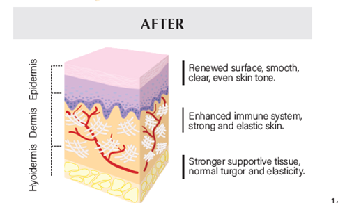 FaceLift Reformation System