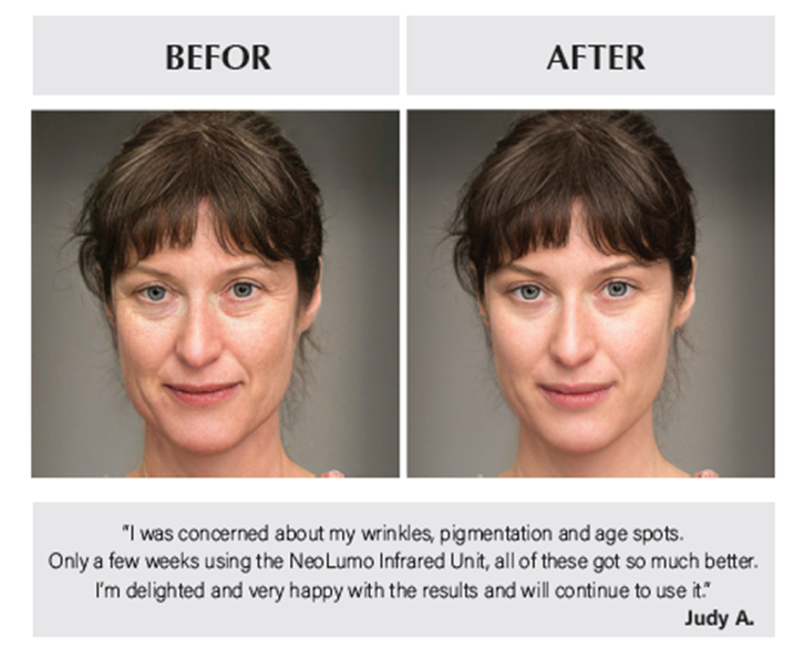 FaceLift Reformation System